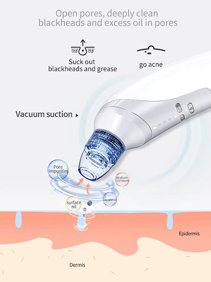Fantastic Electric Blackhead And Acne Suction